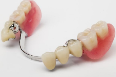 Dentures